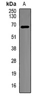 BTRC antibody