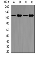 Anti-E6AP Antibody