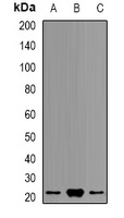 Anti-PSMB9 Antibody