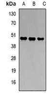 Anti-PBGD Antibody