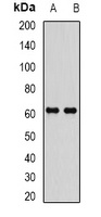 Anti-EPHX2 Antibody