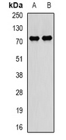 Anti-PADI4 Antibody