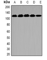 Anti-OGT Antibody