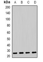Anti-AK4 Antibody