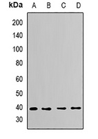 Anti-CapZ alpha-2 Antibody