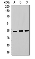 Anti-TorsinA Antibody