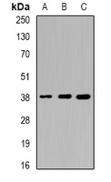 Anti-Sorbitol Dehydrogenase Antibody
