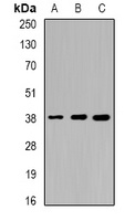 SORD antibody