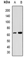 Anti-SPAM1 Antibody