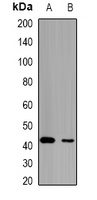 Anti-HCCR-1 Antibody