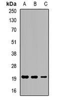Anti-Eppin Antibody