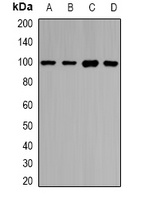 Anti-HIWI1 Antibody