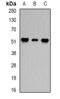 Anti-PPP2R2A Antibody