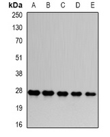 PSMA6 antibody