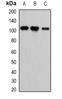 Anti-CASK Antibody