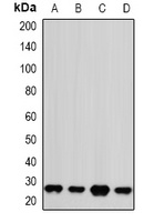 Anti-PSMA2 Antibody