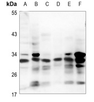 Anti-PRG2 Antibody