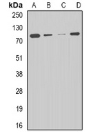 Anti-CPT2 Antibody