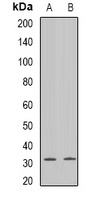 GJB3 antibody