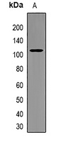 Anti-PIBF Antibody