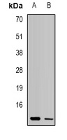 Anti-UQCR10 Antibody
