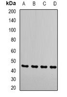Anti-RRM2 Antibody