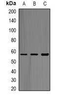 Anti-ABAT Antibody
