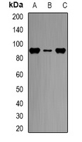Anti-CPT1A Antibody