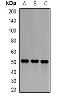 Anti-Epsilon-sarcoglycan Antibody