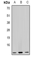 Anti-GHRH Antibody