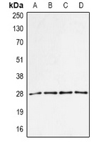 Anti-PA28 alpha Antibody