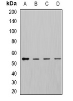 Anti-DLD Antibody