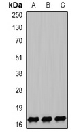 NPC2 antibody