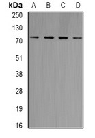 Anti-GlyRS Antibody