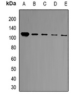 Anti-BCL11A Antibody