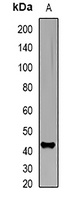 Anti-ADH4 Antibody