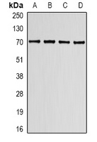 Anti-Lamin B Receptor Antibody