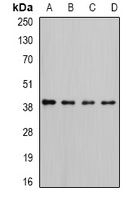 Anti-RFC4 Antibody