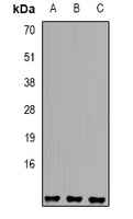 Anti-Sm E Antibody