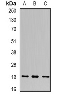 UBE2C antibody