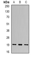 Anti-UBE2C Antibody