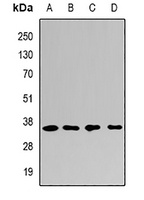 Anti-PSMF1 Antibody