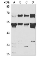 Anti-LSF Antibody
