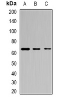Anti-Asparagine Synthetase Antibody