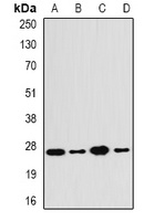 Anti-PA28 beta Antibody