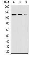 Anti-SKIV2L2 Antibody