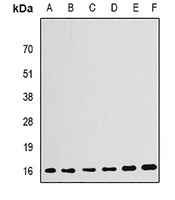 GABARAP antibody