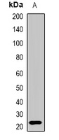 Anti-Interferon lambda-3 Antibody