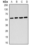 Anti-FH Antibody