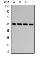 Anti-HADHB Antibody